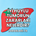 İyi Huylu Tümörün Zararları Nelerdir?