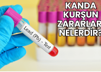 Kanda Kurşun Zararları Nelerdir?