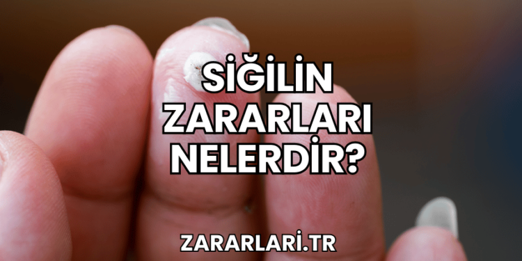 Siğilin Zararları Nelerdir?