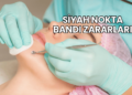 Siyah Nokta Bandı Zararları