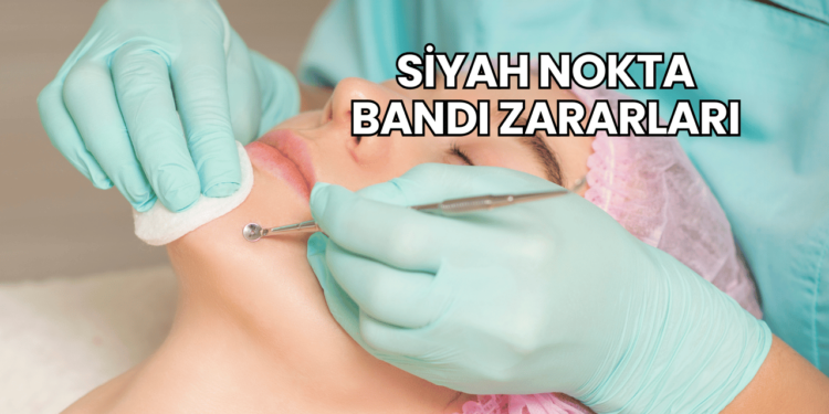 Siyah Nokta Bandı Zararları
