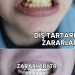 Diş Tartarının Zararları