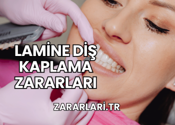 Lamine Diş Kaplama Zararları