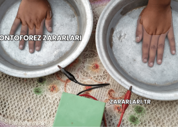 İyontoforez Zararları