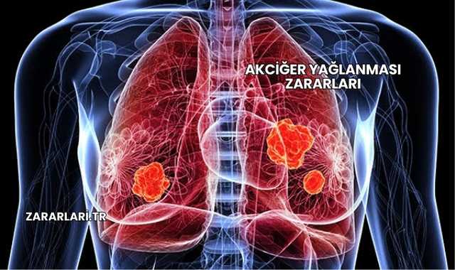 Akciğer Yağlanması Zararları