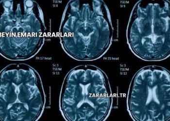 Beyin Emarı Zararları