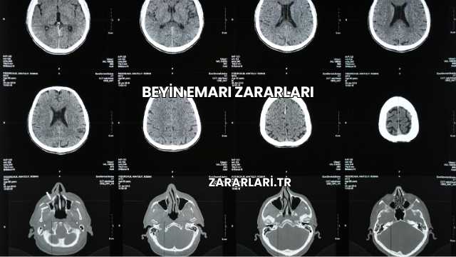 Beyin Emarı Zararları