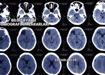 Beyinde Lezyonun Zararları