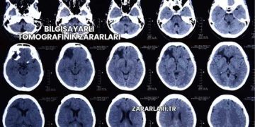 Beyinde Lezyonun Zararları
