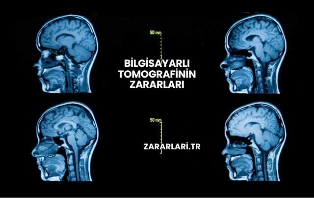 Bilgisayarlı Tomografinin Zararları