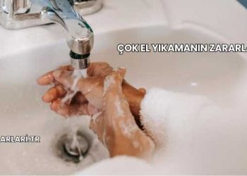 Çok El Yıkamanın Zararları