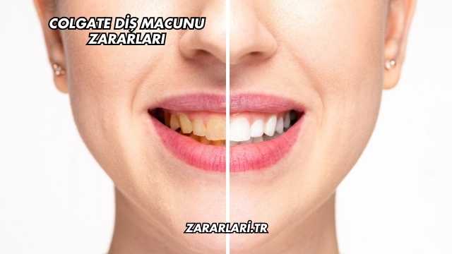 Colgate Diş Macunu Zararları