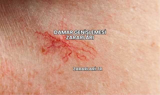 Damar Genişlemesi Zararları
