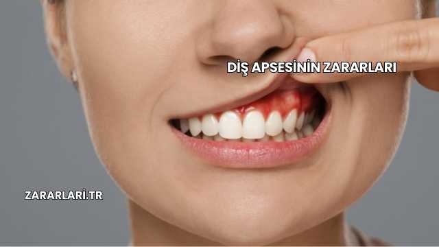 Diş Apsesinin Zararları