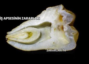 Diş Apsesinin Zararları
