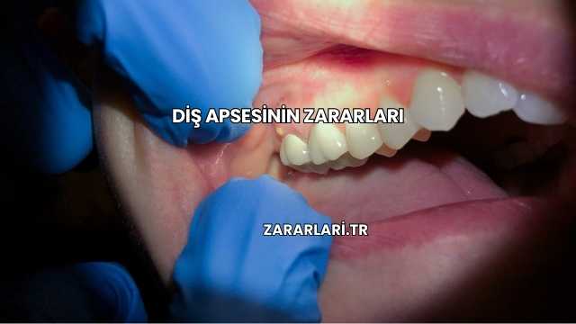 Diş Apsesinin Zararları