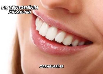 Diş Röntgeninin Zararları