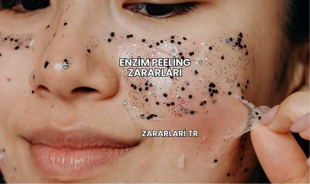 Enzim Peeling Zararları