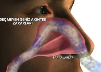 Geçmeyen Geniz Akıntısı Zararları