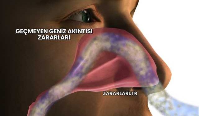 Geçmeyen Geniz Akıntısı Zararları