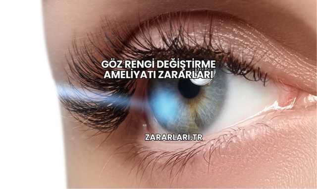 Göz Rengi Değiştirme Ameliyatı ZararlarıGöz Rengi Değiştirme Ameliyatı Zararları