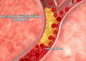 Kolesterol Yüksekliğinin Zararları