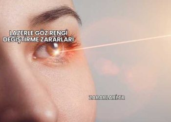 Lazerle Göz Rengi Değiştirme Zararları