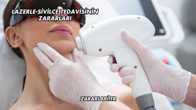 Lazerle Sivilce Tedavisinin Zararları