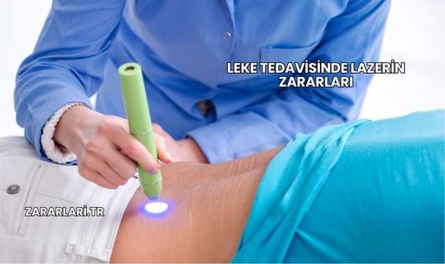 Leke Tedavisinde Lazerin Zararları