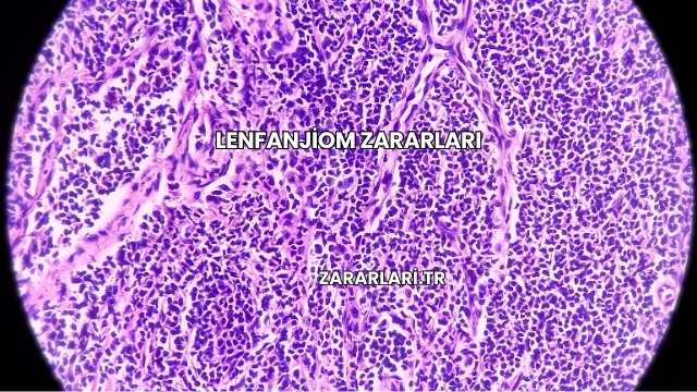 Lenfanjiom Zararları