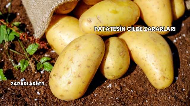 Patatesin Cilde Zararları