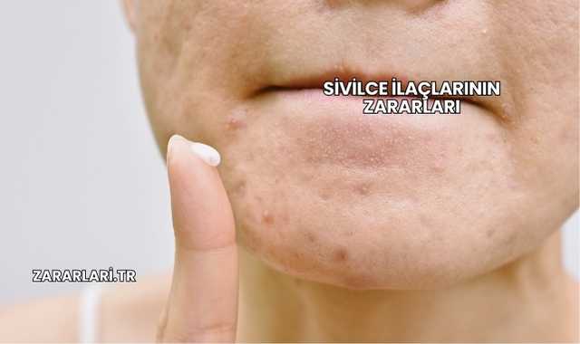 Sivilce İlaçlarının Zararları