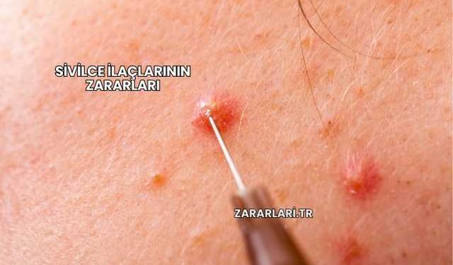 Sivilce İlaçlarının Zararları