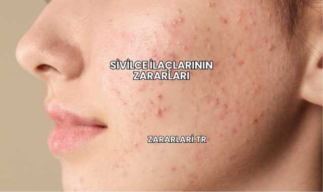 Sivilce İlaçlarının Zararları
