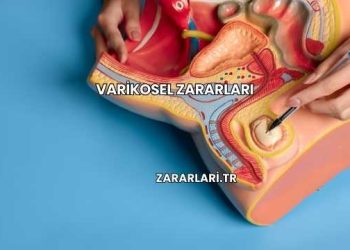 Varikosel Zararları