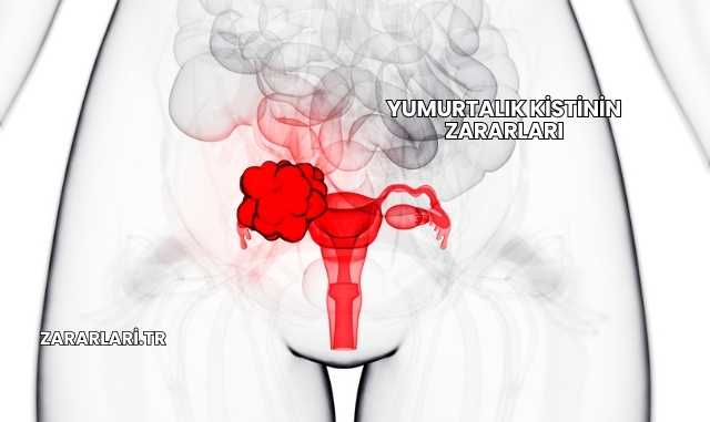 Yumurtalık Kistinin Zararları