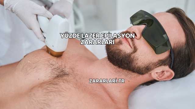 Yüzde Lazer Epilasyon Zararları