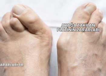 Ayağa Takılan Platinin Zararları