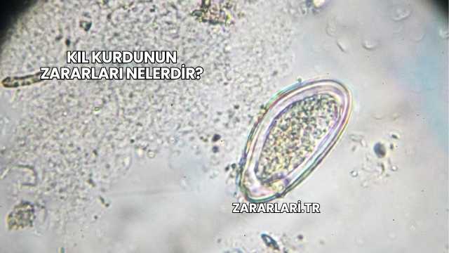 Kıl Kurdunun Zararları Nelerdir?