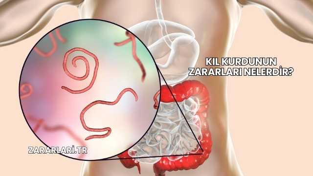 Kıl Kurdunun Zararları Nelerdir?