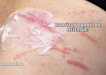 Kortizon Zararları Nelerdir?