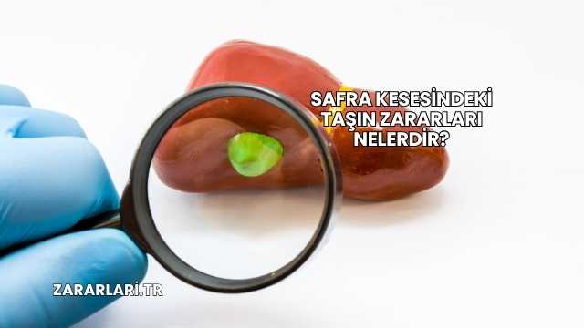 Safra Kesesindeki Taşın Zararları Nelerdir?