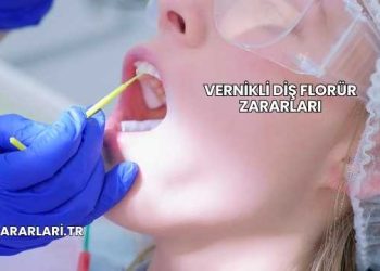 Vernikli Diş Florür Zararları