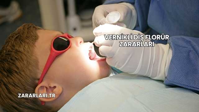 Vernikli Diş Florür Zararları