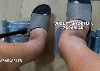 Vücuttaki Ödemin Zararları