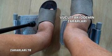 Vücuttaki Ödemin Zararları
