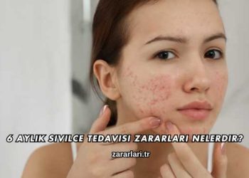 6 Aylık Sivilce Tedavisi Zararları Nelerdir?