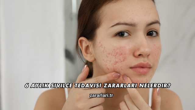 6 Aylık Sivilce Tedavisi Zararları Nelerdir?
