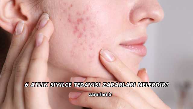 6 Aylık Sivilce Tedavisi Zararları Nelerdir?