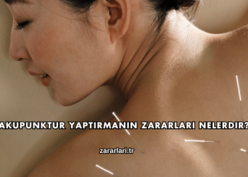 Akupunktur Yaptırmanın Zararları Nelerdir?